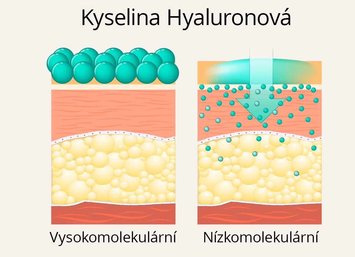 hyaluronva kys  cz.jpg